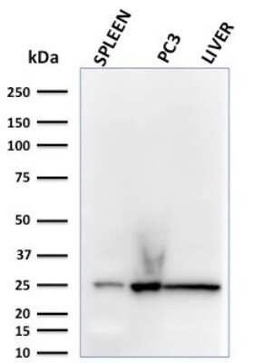 Western Blot: Complement Component C1qA Antibody (C1QA/2783)Azide and BSA Free [NBP2-79915]