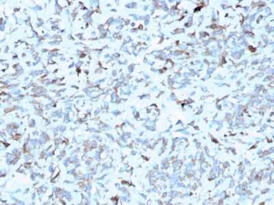 Immunohistochemistry-Paraffin: Complement Component C1qA Antibody (C1QA/2952) - Azide and BSA Free [NBP3-08746]