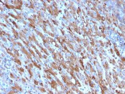 Immunohistochemistry-Paraffin: Complement Component C1qA Antibody (C1QA/2954) - Azide and BSA Free [NBP2-79919]