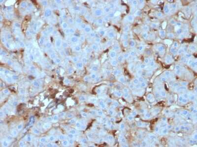 Immunohistochemistry-Paraffin: Complement Component C1qA Antibody (C1QA/2955) - Azide and BSA Free [NBP3-08748]