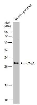 Western Blot: Complement Component C1qA Antibody [NBP3-13331]