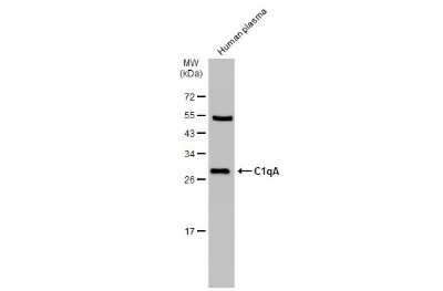Western Blot: Complement Component C1qA Antibody [NBP3-13331]