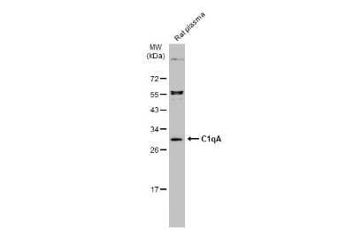 Western Blot: Complement Component C1qA Antibody [NBP3-13331]