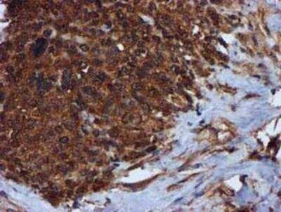 Immunohistochemistry-Paraffin: Complement Component C1s Antibody (OTI4E3) [NBP2-01625]
