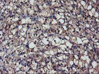 Immunohistochemistry-Paraffin: Complement Component C1s Antibody (OTI4E3) [NBP2-01625]
