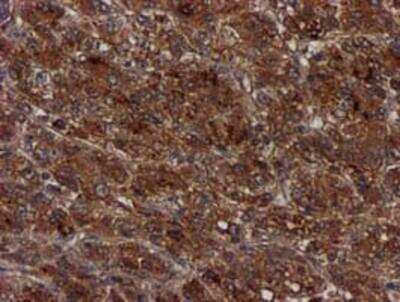 Immunohistochemistry-Paraffin: Complement Component C1s Antibody (OTI4E3) [NBP2-01625]