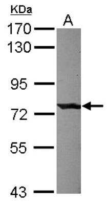 Western Blot: Complement Component C1s Antibody [NBP2-15643]