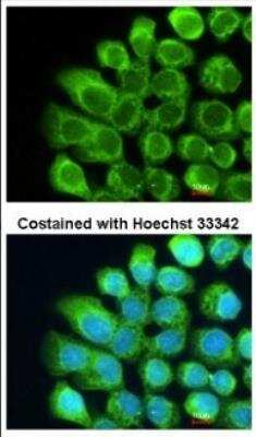 Immunocytochemistry/ Immunofluorescence: Complement Component C2 Antibody [NBP1-32589]
