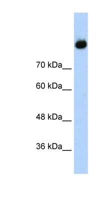 Western Blot: Complement Component C2 Antibody [NBP1-58985]