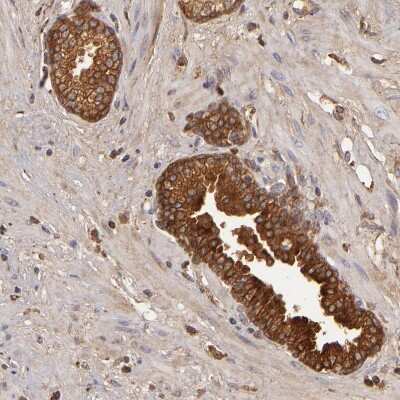 Immunohistochemistry-Paraffin: Complement Factor B Antibody [NBP1-89985]
