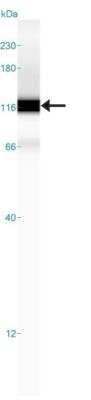 Simple Western: Complement Factor B Antibody [NBP1-89985]
