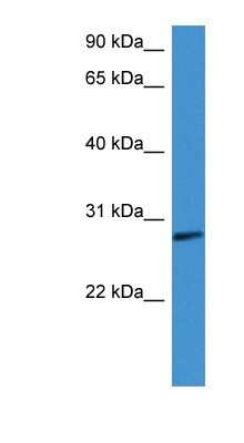 Western Blot: Complement Factor D/Adipsin Antibody [NBP1-79793]