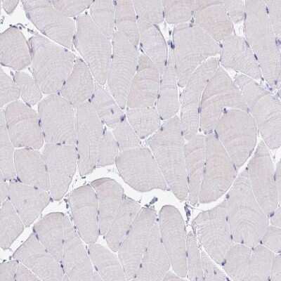 Immunohistochemistry-Paraffin: Complement Factor H Antibody [NBP2-38695]