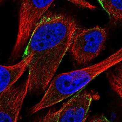 Immunocytochemistry/ Immunofluorescence: Complement Factor H-related 1/CFHR1/CFHL1 Antibody [NBP2-14474]