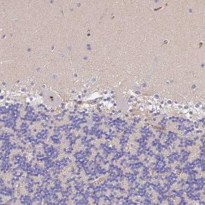 Immunohistochemistry-Paraffin: Complement Factor H-related 1/CFHR1/CFHL1 Antibody [NBP2-14474]