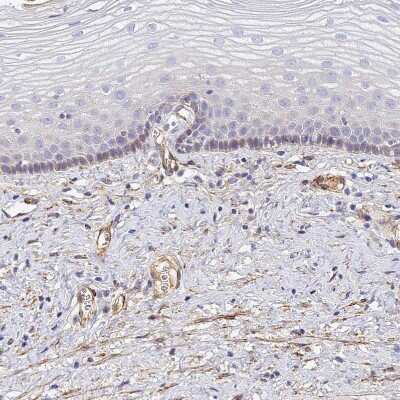 Immunohistochemistry-Paraffin: Complement Factor H-related 1/CFHR1/CFHL1 Antibody [NBP2-14474]