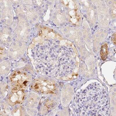 Immunohistochemistry-Paraffin: Complement Factor H-related 1/CFHR1/CFHL1 Antibody [NBP2-14474]