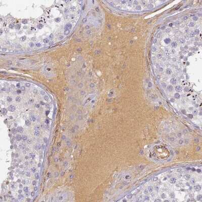 Immunohistochemistry-Paraffin: Complement Factor H-related 1/CFHR1/CFHL1 Antibody [NBP2-14474]
