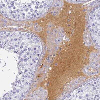 Immunohistochemistry-Paraffin: Complement Factor H-related 1/CFHR1/CFHL1 Antibody [NBP2-54683]
