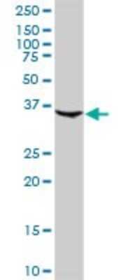 Western Blot: Complement Factor H-related 1/CFHR1/CFHL1 Antibody [H00003078-D01P]