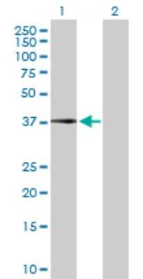 Western Blot: Complement Factor H-related 1/CFHR1/CFHL1 Antibody [H00003078-D01P]