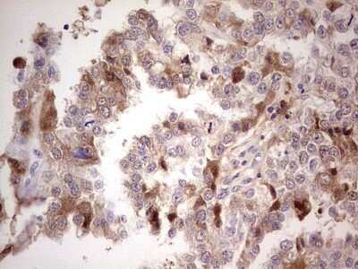 Immunohistochemistry-Paraffin: Complement Factor I Antibody (OTI7C9) [NBP2-46264]