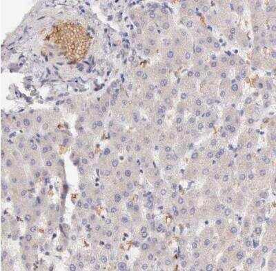 Immunohistochemistry-Paraffin: Complement Factor I Antibody [NBP1-88268]