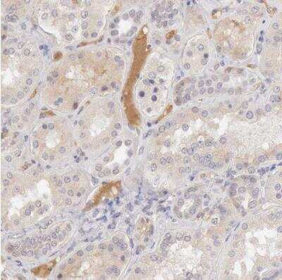 Immunohistochemistry-Paraffin: Complement Factor I Antibody [NBP1-88268]
