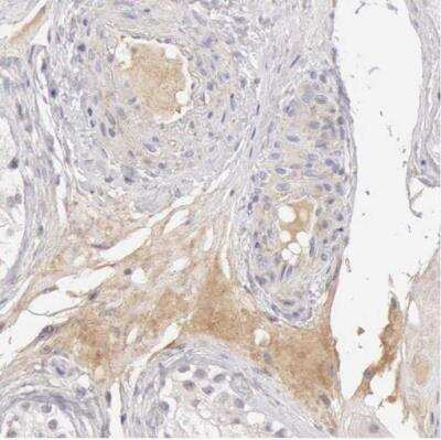 Immunohistochemistry-Paraffin: Complement Factor I Antibody [NBP1-88268]