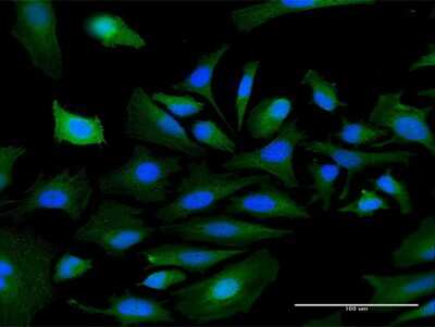 Immunocytochemistry/ Immunofluorescence: Complement Factor MASP3/MASP1 Antibody [H00005648-B01P]