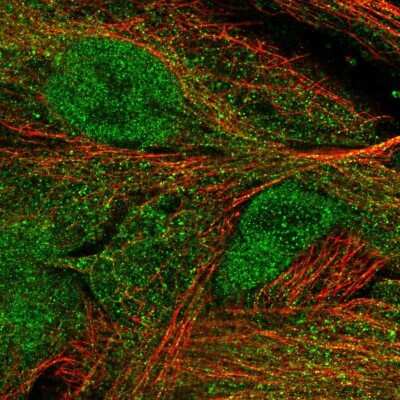Immunocytochemistry/ Immunofluorescence: Complement Factor MASP3/MASP1 Antibody [NBP1-85460]