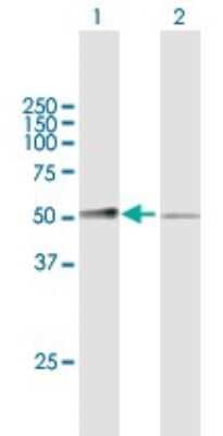Western Blot: Complement Factor MASP3/MASP1 Antibody [H00005648-B01P]