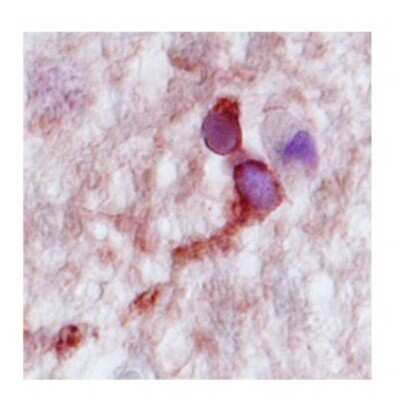 Immunohistochemistry-Paraffin: Complexin-2 Antibody [NBP1-57001]