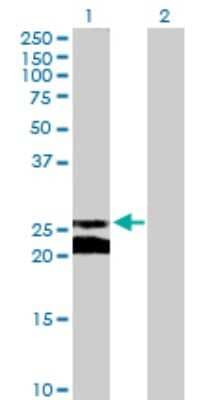 Western Blot: Connexin 30.1/GJB5 Antibody [H00002709-B02P]