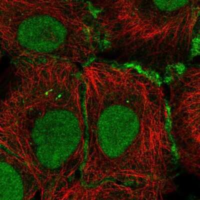 Immunocytochemistry/ Immunofluorescence: Connexin 30.3/GJB4 Antibody [NBP2-55398]