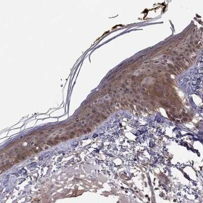 Immunohistochemistry-Paraffin: Connexin 30.3/GJB4 Antibody [NBP3-17078]
