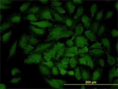 Immunocytochemistry/ Immunofluorescence: Connexin 31/GJB3 Antibody (3B4-1B3) [H00002707-M01]