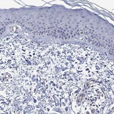 Immunohistochemistry-Paraffin: Connexin 40/GJA5 Antibody [NBP3-17079]