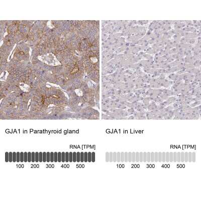 Immunohistochemistry-Paraffin: Connexin 43/GJA1 Antibody [NBP2-38234]