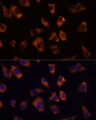 Immunocytochemistry/ Immunofluorescence: Connexin 50/GJA8 Antibody - Azide and BSA Free [NBP3-15748]