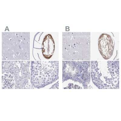 Immunohistochemistry-Paraffin: Connexin 50/GJA8 Antibody [NBP2-68589]