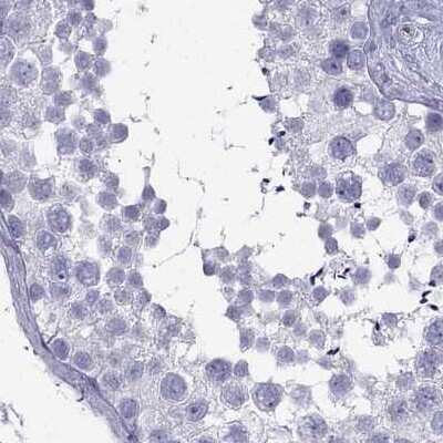 Immunohistochemistry-Paraffin: Connexin 50/GJA8 Antibody [NBP2-68799]