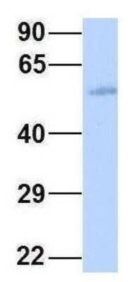 Western Blot: Connexin 58/GJA9 Antibody [NBP1-59196]