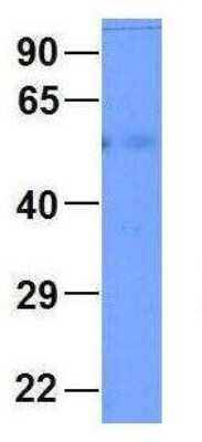 Western Blot: Connexin 58/GJA9 Antibody [NBP1-59196]