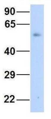 Western Blot: Connexin 58/GJA9 Antibody [NBP1-59196]