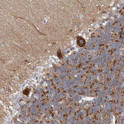 Immunohistochemistry-Paraffin: Copine-6 Antibody [NBP1-87521]