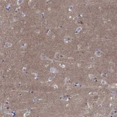 Immunohistochemistry-Paraffin: Copine-6 Antibody [NBP3-17234]