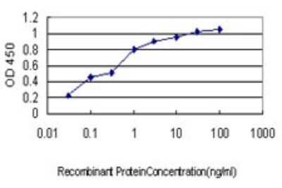 ELISA: Corneodesmosin Antibody (6F11) [H00001041-M01]