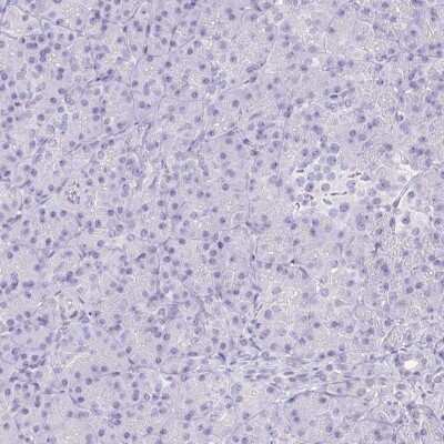Immunohistochemistry-Paraffin: Corneodesmosin Antibody [NBP2-37942]