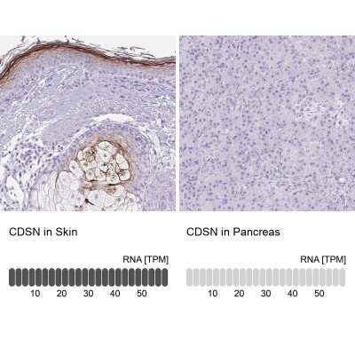 Immunohistochemistry-Paraffin: Corneodesmosin Antibody [NBP2-37942]